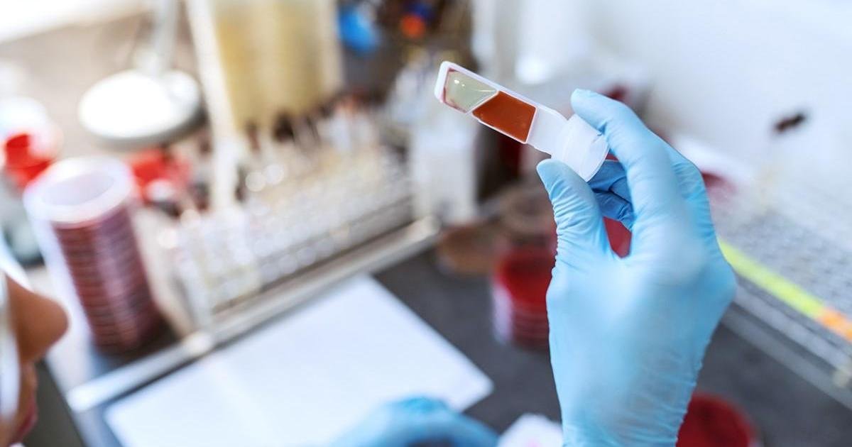 Maltalı Bilim İnsanları Erken Kanser Teşhisi İçin Damlacık Bazlı Test Geliştirdi