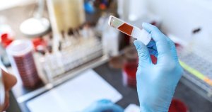Maltalı Bilim İnsanları Erken Kanser Teşhisi İçin Damlacık Bazlı Test Geliştirdi