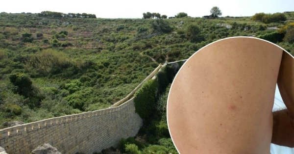 Victoria Lines'ta antrenman yapan bisikletliye av tüfeği saçması isabet etti