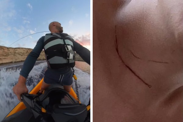 Dingli açıklarında denize gerili halat jet ski sürücülerini alarma geçirdi